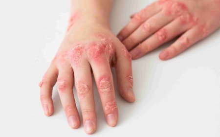 Don't take skin disorders for granted, new study