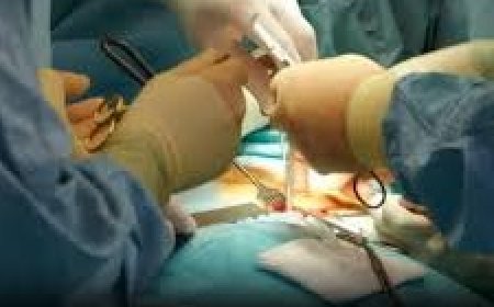 Doctors removed two kilos of hair from the patient's stomach