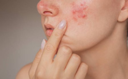 گرمی کے موسم میں دانوں کی مشکل کیسے دور ہو؟