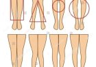 WOMAN'S LEGS CAN TELL HOW HER IS